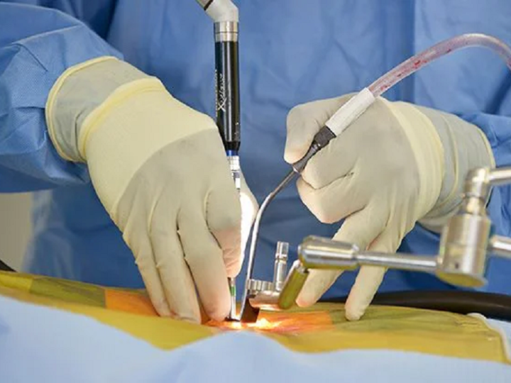 When Is Minimally Invasive Spine Surgery the Best Option?