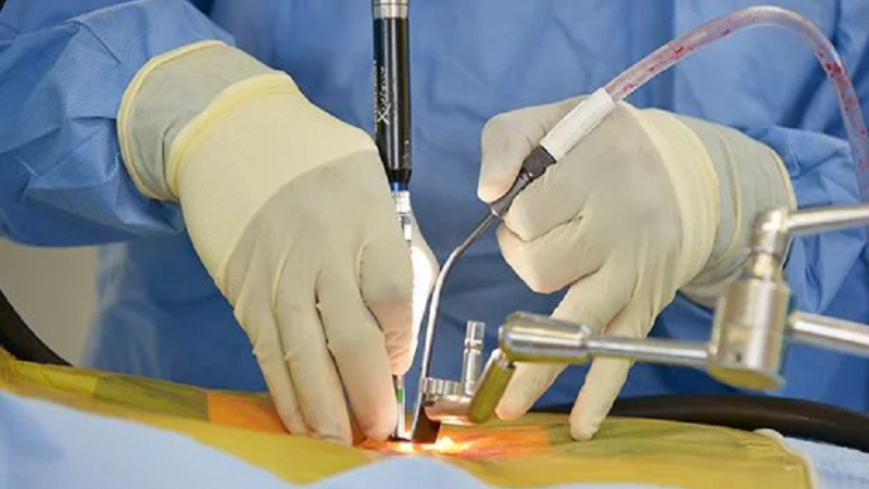 When Is Minimally Invasive Spine Surgery the Best Option?