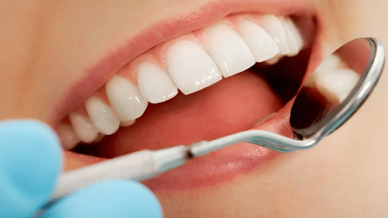 Veneers Newport Beach: Are Porcelain Veneers Worth the Investment?